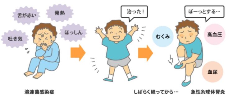 急性腎炎はどのように診断されますか?