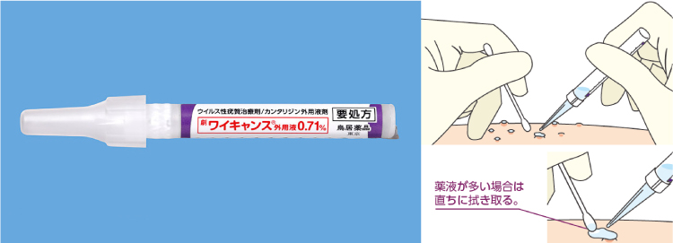 ワイキャンス外用液